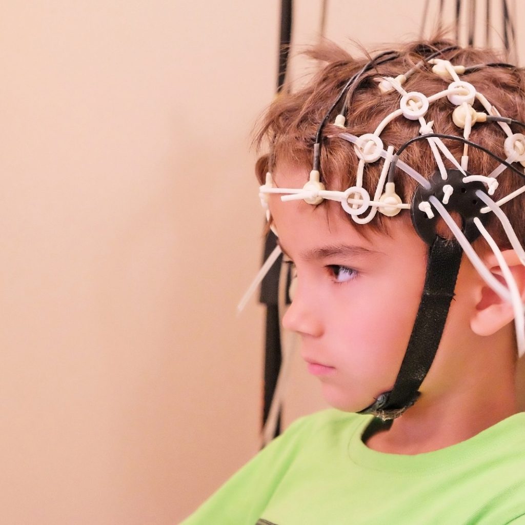 whatsapp-image-2020-04-22-at-12.02.12-am a child getting a brain test
