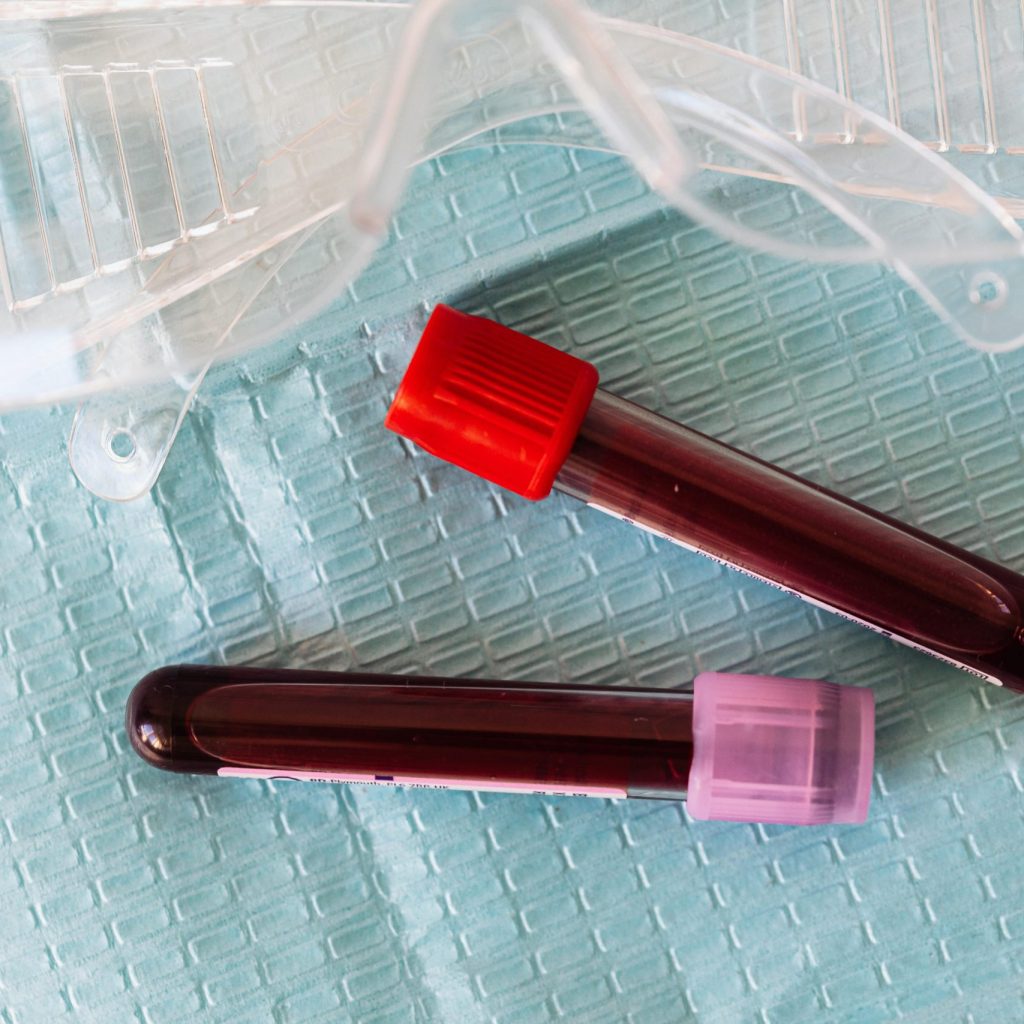 medical eyeglasses and two vials full of blood on a blue lab sheet